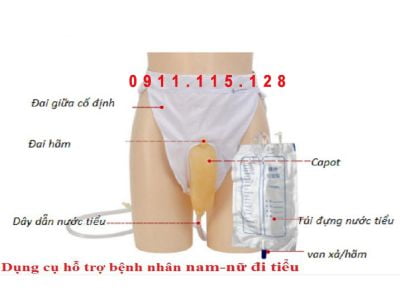 Dụng cụ hỗ trợ đi tiểu cho bệnh nhân