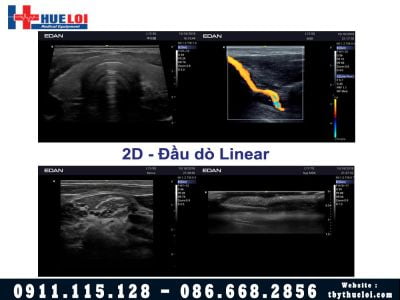 Máy Siêu Âm 4D EDAN AX3 - Công Nghệ Vượt Tầm Phân Khúc 