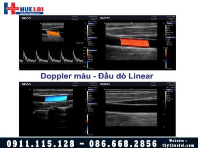 Máy Siêu Âm 4D EDAN AX3 - Công Nghệ Vượt Tầm Phân Khúc 